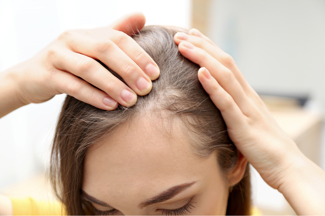 Woman parting the hair at her crown to reveal a sparse, thinning section at the scalp