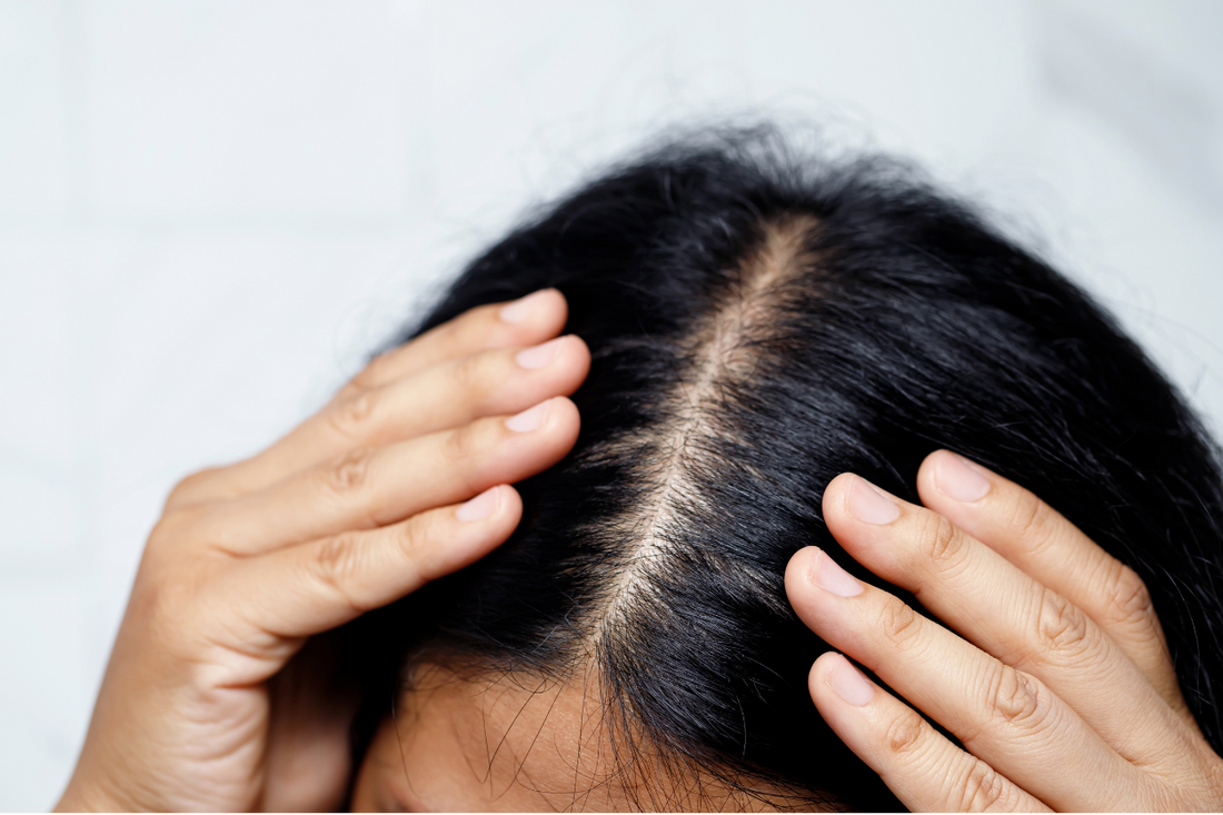 Overhead close-up of two hands parting dark hair down the middle to reveal the scalp along the part line.